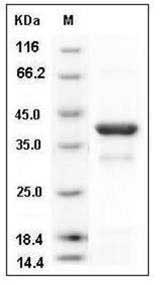 Human IKB alpha / NFKBIA Protein (His Tag) SDS-PAGE