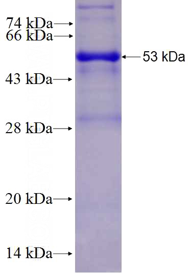 Recombinant Human WDR88 SDS-PAGE