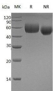 Human APOH/B2G1 (His tag) recombinant protein