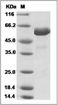 Human VSIG8 Protein (Fc Tag) SDS-PAGE