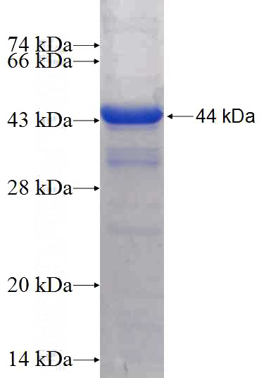 Recombinant Human GBP4 SDS-PAGE