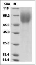 HCV-E2 protein SDS-PAGE