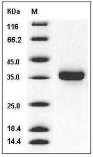 Human KLK-8 / Kallikrein-8 Protein (His Tag) SDS-PAGE