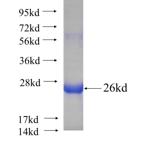 Human MAD2L1 Recombinant protein (His tag)