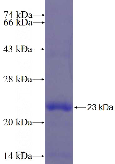 Recombinant Mouse IL-1B SDS-PAGE