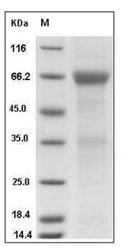Human ADCYAP1R1 Protein (Fc Tag) SDS-PAGE