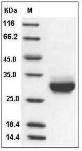 Rat CRP / C-Reactive Protein (His Tag) SDS-PAGE