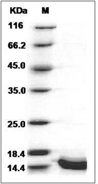 Human Cystatin A / CSTA Protein (His Tag) SDS-PAGE