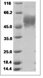 Human ATPase Na+/ K+ beta 2 Protein 15485