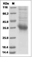 Human RAET1E / ULBP4 Protein (His Tag) SDS-PAGE