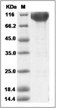Human KIT / c-KIT / CD117 Protein (Fc Tag) SDS-PAGE