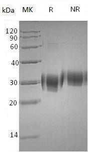 Human ULBP2/N2DL2/RAET1H/UNQ463/PRO791 (His tag) recombinant protein