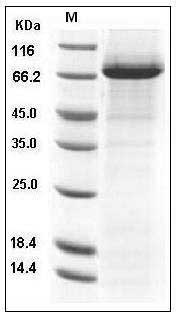 Human Coagulation Factor XI / FXI / F11 Protein (His Tag) SDS-PAGE