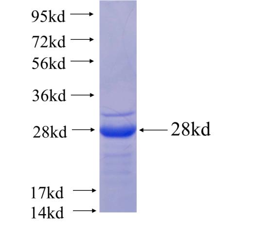 Recombinant human ARMC7(Full length) SDS-PAGE
