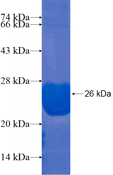 Recombinant Human C20orf112 SDS-PAGE