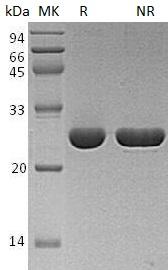 Human UCHL3 (His tag) recombinant protein