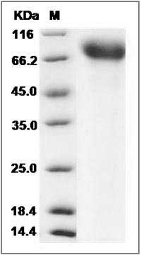 Mouse TrkA / NTRK1 Protein (His Tag) SDS-PAGE