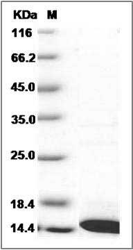 Human COX5B Protein (His Tag) SDS-PAGE