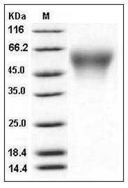 Mouse CD34 Protein (His Tag) SDS-PAGE