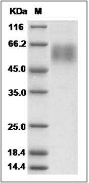 Cynomolgus CD62L / L-Selectin / SELL Protein (His Tag) SDS-PAGE