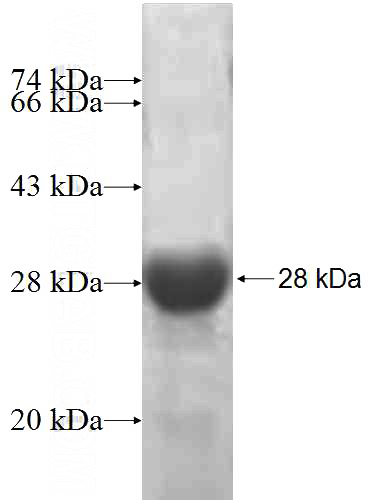 Recombinant Human SLC12A1 SDS-PAGE