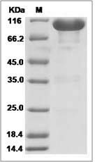 Rat EphA7 / Eph Receptor A7 Protein (Fc Tag)