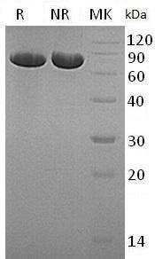 Human PDIA4/ERP70/ERP72 (His tag) recombinant protein