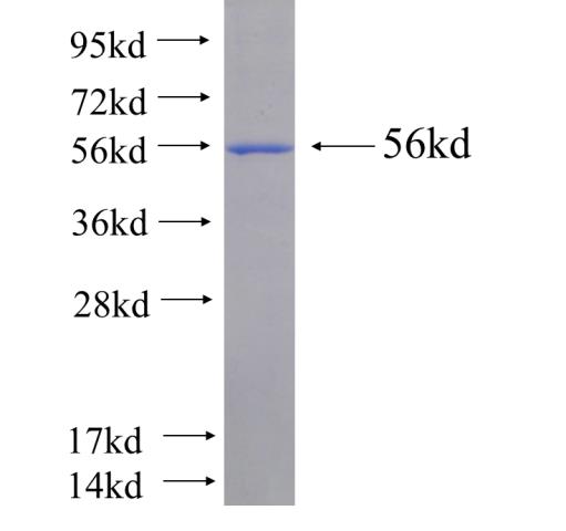 Recombinant human CNP(Full length) SDS-PAGE