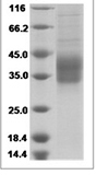 Human IL12A & IL27B Heterodimer Protein