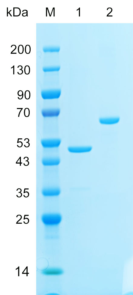 Recombinant ROCK2 protein (His tag) SDS-PAGE