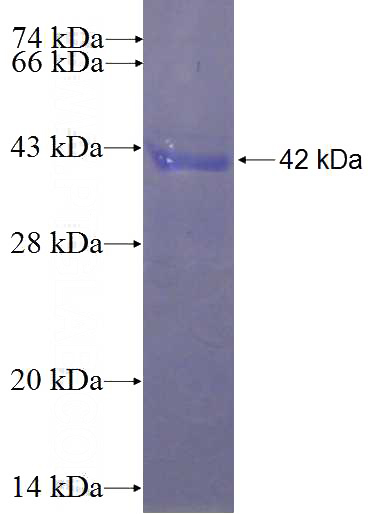 Recombinant Human WDR34 SDS-PAGE