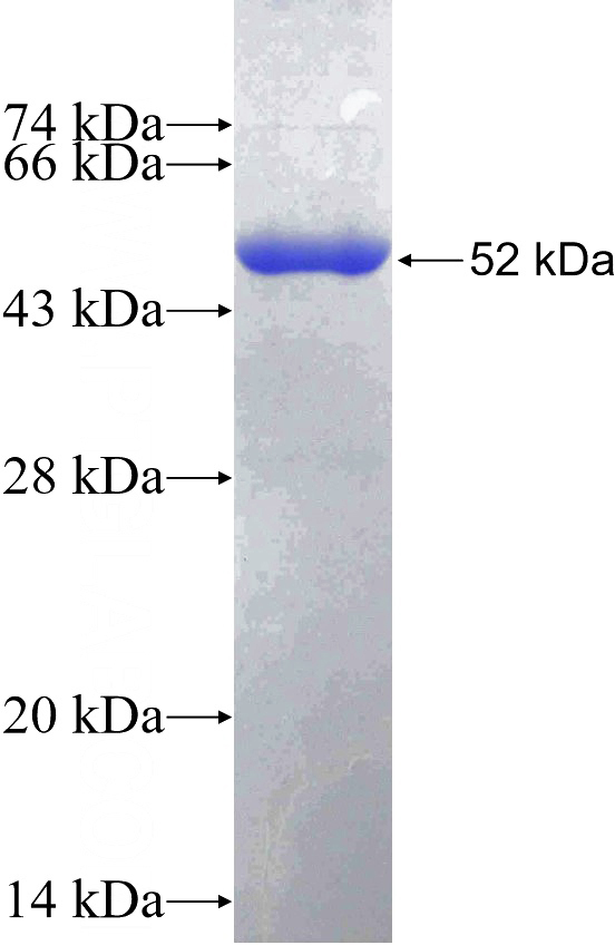 Recombinant Human NR2F1 SDS-PAGE