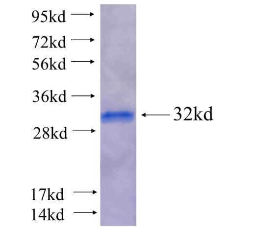 Recombinant Arabidopsis thaliana MYC3 SDS-PAGE