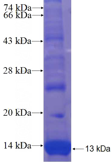 Human GLT25D2 Recombinant protein (6*His tag)