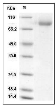 Influenza B (B/Brisbane/60/2008) Hemagglutinin / HA Protein (His Tag) SDS-PAGE