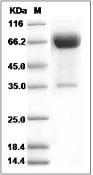 Rat OLR1 / LOX1 Protein (Fc Tag) SDS-PAGE