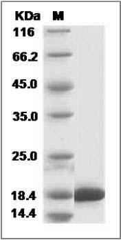 Human RBP5 / Retinol binding protein 5 Protein (His Tag) SDS-PAGE