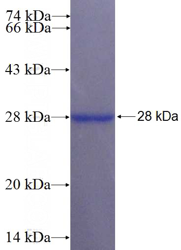 Recombinant Human LRRC29 SDS-PAGE
