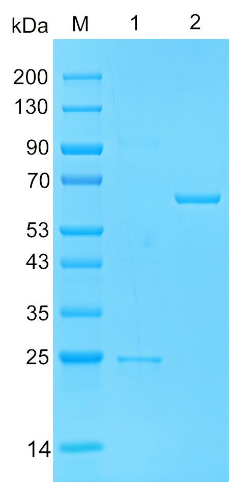 Recombinant MND1 protein (His tag) SDS-PAGE