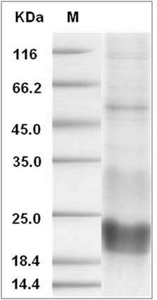 Human CD3e / CD3 epsilon Protein (His Tag)