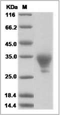 Mouse WAP5 / WFDC2 / HE4 Protein (His Tag) SDS-PAGE