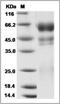 Human PROC1 / Protein C / PROC Protein (His Tag) SDS-PAGE
