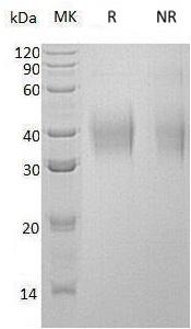 Human CD300C/CMRF35/CMRF35A (His tag) recombinant protein