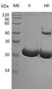Human TREML1/TLT1/UNQ1825/PRO3438 (His tag) recombinant protein