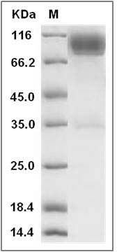 Rat CD111 / Nectin-1 / PVRL1 Protein (Fc Tag) SDS-PAGE