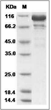 Mouse CD45 / PTPRC Protein (aa 453-1152, His & GST Tag) SDS-PAGE