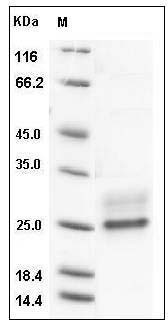 Ferret CD20 / MS4A-1 Protein (His Tag) SDS-PAGE