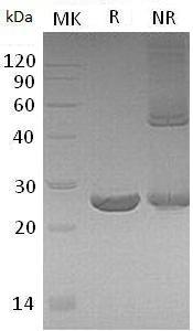 Human PRDX1/PAGA/PAGB/TDPX2 (His tag) recombinant protein