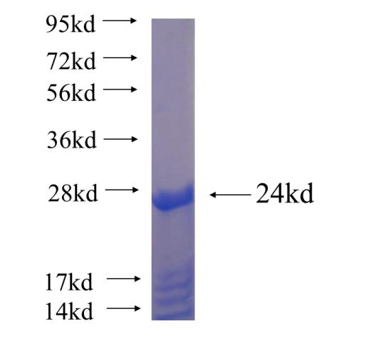 Recombinant human HOXD12 SDS-PAGE