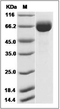 Influenza A H7N9 (A/Pigeon/Shanghai/S1069/2013) Hemagglutinin / HA Protein (His Tag) SDS-PAGE